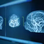 Risonanza magnetica: cos’è e quali sono le indicazioni